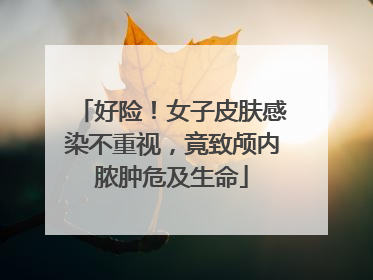 好险！女子皮肤感染不重视，竟致颅内脓肿危及生命